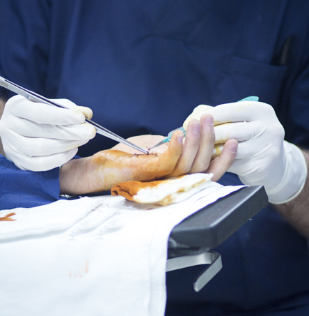 Hand and Microsurgery