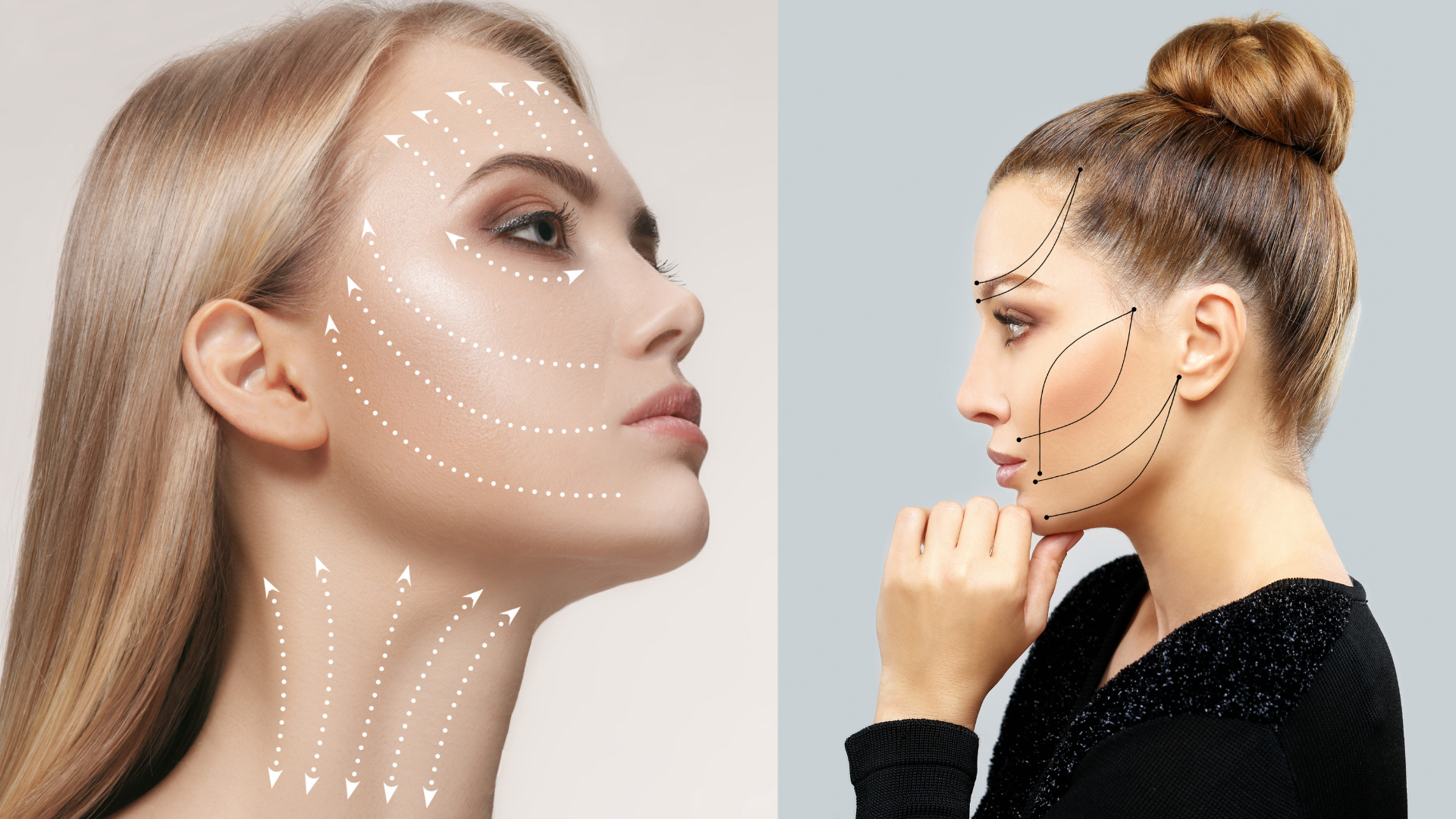 Non-Surgical Facelift vs Surgical Facelift – Which is Right for You?